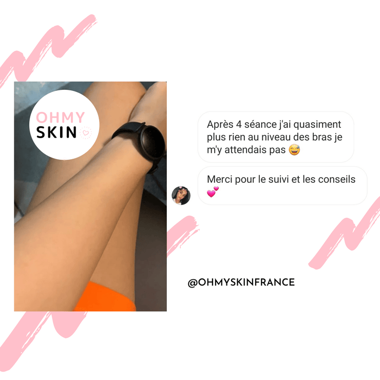Ohmyskin épilateur à lumière pulsée