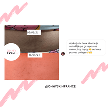Charger l'image dans la galerie, Ohmyskin épilateur à lumière pulsée