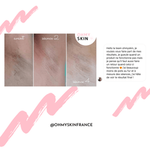 Charger l'image dans la galerie, Ohmyskin épilateur à lumière pulsée